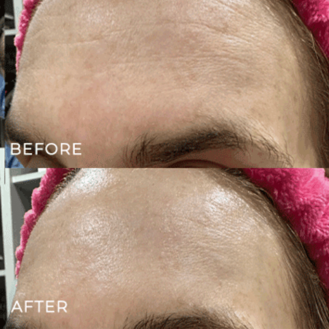 The Miracle Mask - Hydrating & Plumping